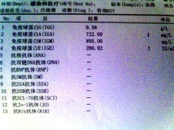 犇牛病毒表现-犇牛病毒：潜伏期惊人短，症状轻微易被忽视