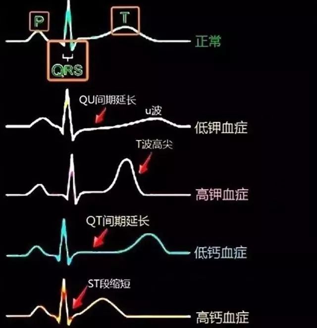 冠心病的护理课件_冠心病的护理课件ppt_冠心病护理课件