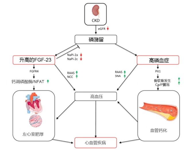 进展性卒中诊断标准_进展性卒中的危险因素有哪些_进展性卒中的原因