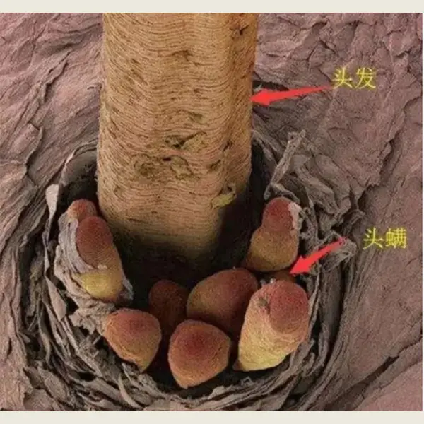 冠心病的护理诊断及护理措施_冠心病的护理诊断措施_护理诊断冠心病措施包括