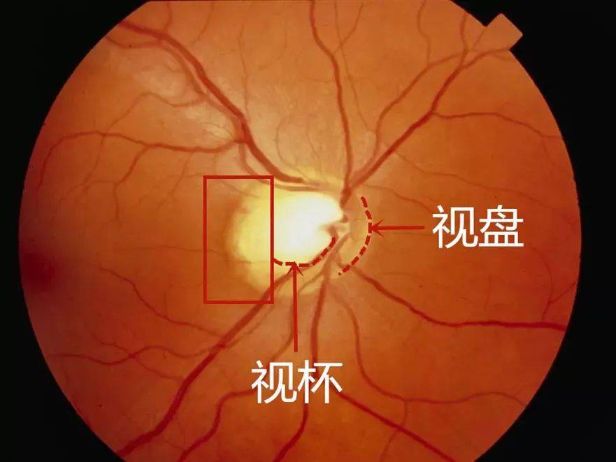 防老人走失的智能环-智能环：解决老年走失问题的新科技，保障老人安全与健康