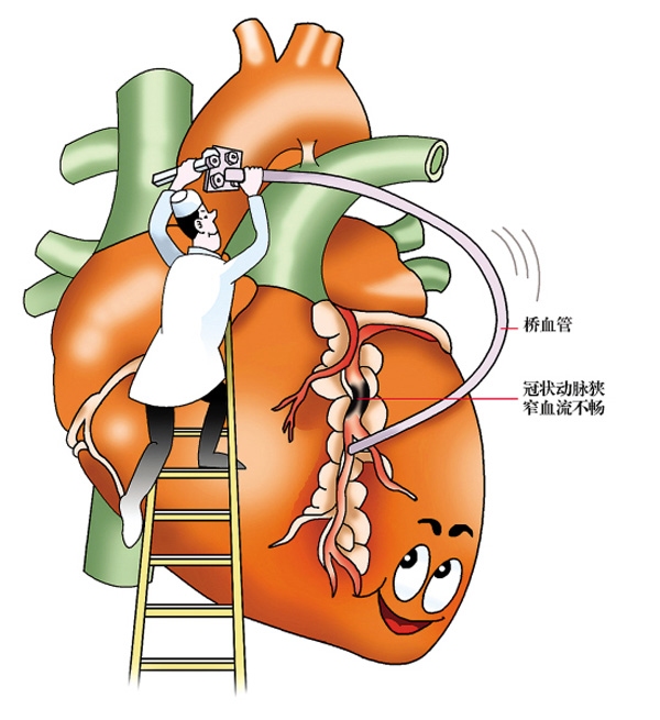 危险冠心病因素不包括_冠心病危险因素是_冠心病危险因素