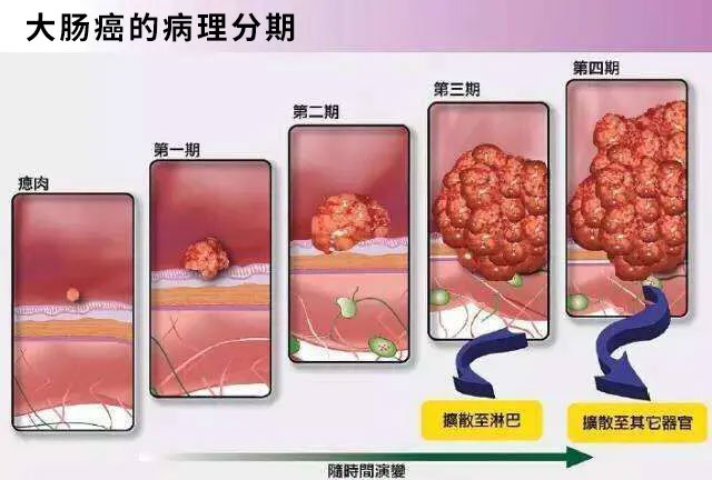 肛门括约肌失禁的鉴别诊断_肛门括约肌失禁_肛门括约肌失禁怎么办